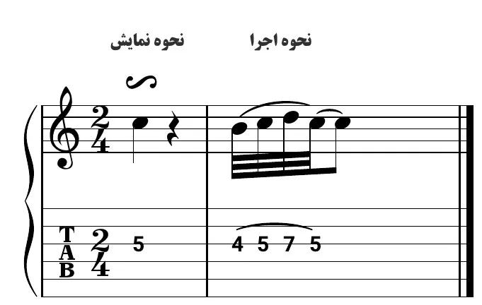 تکنیک قلاب تحتانی